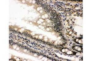 IHC analysis of nmt55/p54nrb using anti-nmt55/p54nrb antibody (ABIN3044530). (NONO Antikörper  (N-Term))