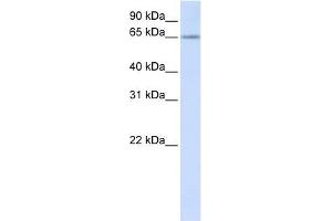 RSPRY1 antibody used at 1 ug/ml to detect target protein. (RSPRY1 Antikörper  (N-Term))