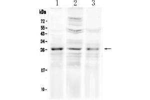 Western blot analysis of FGF8 using anti-FGF8 antibody . (FGF8 Antikörper  (AA 23-233))