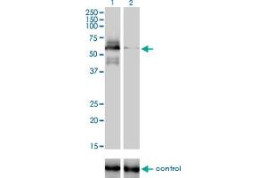 Western blot analysis of RAD18 over-expressed 293 cell line, cotransfected with RAD18 Validated Chimera RNAi (Lane 2) or non-transfected control (Lane 1). (RAD18 Antikörper  (AA 332-430))