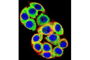 Confocal immunofluorescent analysis of PRKCA Antibody (N-term) (ABIN652517 and ABIN2842346) with Hela cell followed by Alexa Fluor 488-conjugated goat anti-rabbit lgG (green). (PKC alpha Antikörper  (N-Term))