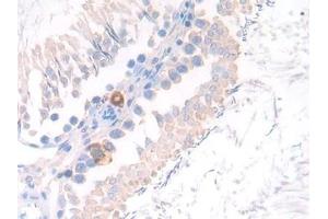 Immunohistochemistry (IHC) image for anti-Membrane Metallo-Endopeptidase (MME) (AA 286-428) antibody (ABIN7438688)