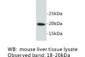 Image no. 1 for anti-Lymphocyte Antigen 6 Complex, Locus A (Ly6a) antibody (ABIN1112928) (Sca-1/Ly-6A/E Antikörper)