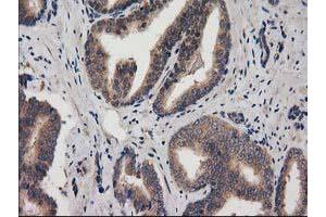 Image no. 9 for anti-Acyl-CoA Thioesterase 12 (ACOT12) antibody (ABIN1496415)