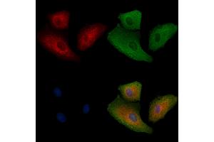 ABIN6262721 and ABIN6278917 staining  cells by IF/ICC. (KRT32 Antikörper  (Internal Region))