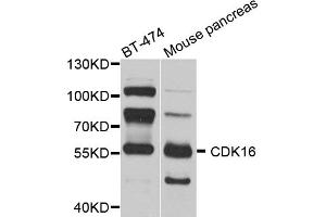 Western blot analysis of extracts of various cell lines, using CDK16 antibody. (CDK16 Antikörper)