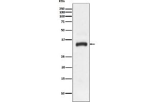 Western blot analysis of JAM1 expression in HeLa cell lysate. (Rekombinanter F11R Antikörper)