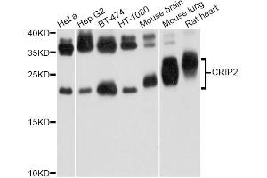 Western blot analysis of extracts of various cell lines, using CRIP2 Antibody. (CRIP2 Antikörper)