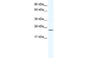WB Suggested Anti-KCTD6 Antibody Titration:  0. (KCTD6 Antikörper  (N-Term))