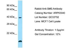 Western Blotting (WB) image for anti-Spermine Synthase, SMS (SMS) (N-Term) antibody (ABIN2789345) (SMS Antikörper  (N-Term))