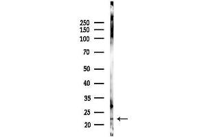 anti-Synovial Sarcoma, X Breakpoint 6 (Pseudogene) (SSX6) antibody
