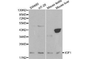 Western blot analysis of extracts of various cell lines, using IGF1 antibody. (IGF1 Antikörper  (C-Term))