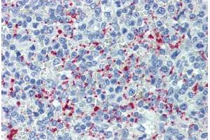 Human Spleen (formalin-fixed, paraffin-embedded) stained with SELP antibody ABIN462342 followed by biotinylated anti-mouse IgG secondary antibody ABIN481714, alkaline phosphatase-streptavidin and chromogen. (P-Selectin Antikörper)