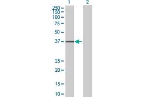 Western Blot analysis of UBE2Q2 expression in transfected 293T cell line by UBE2Q2 MaxPab polyclonal antibody. (UBE2Q2 Antikörper  (AA 1-375))