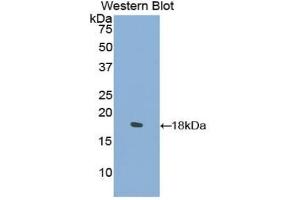 Detection of Recombinant COL2a1, Mouse using Polyclonal Antibody to Collagen Type II Alpha 1 (COL2a1) (COL2A1 Antikörper  (AA 677-817))