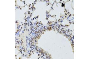 Immunohistochemistry (Paraffin-embedded Sections) (IHC (p)) image for anti-DEAD (Asp-Glu-Ala-Asp) Box Polypeptide 1 (DDX1) (AA 441-740) antibody (ABIN6139477)