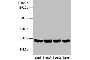 Western blot All lanes: EMC8 antibody at 4 μg/mL Lane 1: A549 whole cell lysate Lane 2: Human placenta tissue Lane 3: Hela whole cell lysate Lane 4: HT29 whole cell lysate Secondary Goat polyclonal to rabbit IgG at 1/10000 dilution Predicted band size: 24, 14 kDa Observed band size: 24 kDa (COX4NB Antikörper  (AA 1-210))