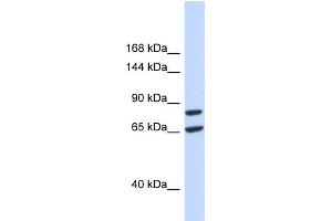 Host:  Rabbit  Target Name:  SLC26A8  Sample Type:  293T Whole Cell lysates  Antibody Dilution:  1. (SLC26A8 Antikörper  (Middle Region))