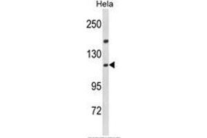 Western blot analysis of IPO11 Antibody (N-term) in Hela cell line lysates (35ug/lane). (Importin 11 Antikörper  (N-Term))