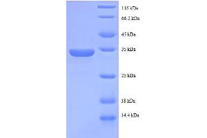 Chromosome 14 Open Reading Frame 2 (C14ORF2) (AA 1-58), (full length) protein (GST tag) (C14orf2 Protein (AA 1-58, full length) (GST tag))