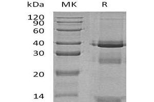 Western Blotting (WB) image for Cathepsin L1 (CTSL1) (AA 18-334) protein (His tag) (ABIN7320749) (Cathepsin L Protein (AA 18-334) (His tag))