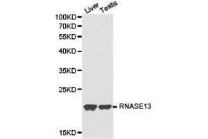 Western Blotting (WB) image for anti-Ribonuclease, RNase A Family, 13 (Non-Active) (RNASE13) antibody (ABIN1874615) (RNASE13 Antikörper)
