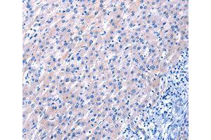 Immunohistochemistry (IHC) image for anti-Epidermal Growth Factor (EGF) antibody (ABIN1872450) (EGF Antikörper)