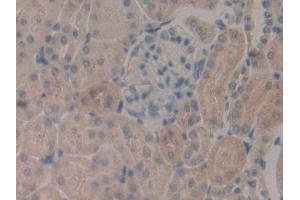Immunohistochemistry (IHC) image for anti-serpin Peptidase Inhibitor, Clade B (Ovalbumin), Member 1 (SERPINB1) (AA 17-332) antibody (ABIN7443074)