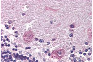 Human Brain, Cerebellum (formalin-fixed, paraffin-embedded) stained with PPP2R3A antibody ABIN337311 at 5 ug/ml followed by biotinylated anti-goat IgG secondary antibody ABIN481715, alkaline phosphatase-streptavidin and chromogen. (PPP2R3A Antikörper  (AA 1073-1085))