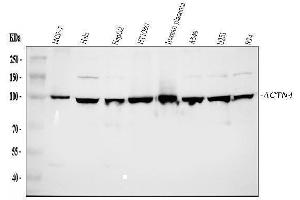 Western blot analysis of Alpha Actinin 4 using anti-Alpha Actinin 4 antibody (ABIN4886421). (alpha Actinin 4 Antikörper  (AA 561-661))