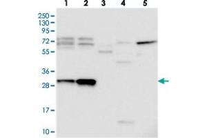 Western blot analysis of Lane 1: RT-4, Lane 2: U-251 MG, Lane 3: Human Plasma, Lane 4: Liver, Lane 5: Tonsil with C15orf23 polyclonal antibody  at 1:250-1:500 dilution. (KNSTRN Antikörper)