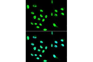 Immunofluorescence (IF) image for anti-Fc Fragment of IgG, Low Affinity IIa, Receptor (CD32) (FCGR2A) (AA 34-316) antibody (ABIN1512904)