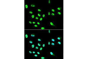 Immunofluorescence analysis of HepG2 cell using FCGR2A antibody.