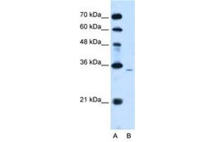 Image no. 1 for anti-Phosphatidic Acid Phosphatase Type 2A (PPAP2A) (AA 136-185) antibody (ABIN204986) (PPAP2A Antikörper  (AA 136-185))