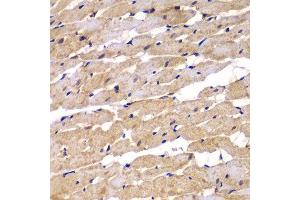 Immunohistochemistry of paraffin-embedded rat heart using PSEN2 antibody. (Presenilin 2 Antikörper)