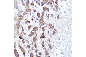 Immunohistochemistry (IHC) image for anti-NADH Dehydrogenase (Ubiquinone) 1 beta Subcomplex, 4, 15kDa (NDUFB4) (AA 1-90) antibody (ABIN6144476)
