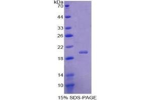 SDS-PAGE analysis of Human Acid Phosphatase 1 Protein. (ACP1 Protein)
