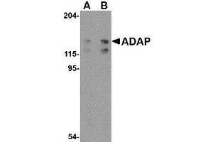 Western blot analysis of ADAP in K562 cell lysate with AP30019PU-N ADAP antibody at (A) 0. (FYB Antikörper  (C-Term))