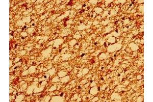 Immunohistochemistry of paraffin-embedded human brain tissue using ABIN7172938 at dilution of 1:100