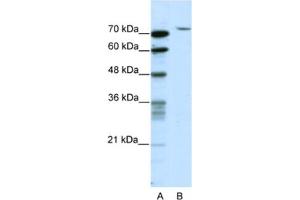 Western Blotting (WB) image for anti-TAF6 RNA Polymerase II, TATA Box Binding Protein (TBP)-Associated Factor, 80kDa (TAF6) antibody (ABIN2461761) (TAF6 Antikörper)