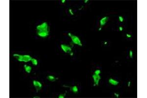 Immunofluorescence staining of human LNCaP cell colony with STEAP1 monoclonal antibody, clone J2D2 . (STEAP1 Antikörper  (AA 1-70))