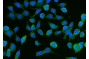 IF analysis of DCP1A using anti-DCP1A antibody (ABIN7601317).
