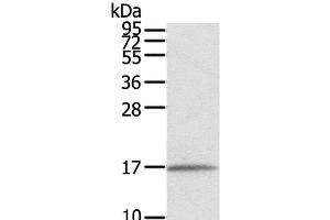 Western Blot analysis of Human normal liver tissue using EVA1A Polyclonal Antibody at dilution of 1:550 (TMEM166 Antikörper)