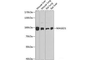 Western blot analysis of extracts of various cell lines using MAGED1 Polyclonal Antibody at dilution of 1:1000. (MAGED1 Antikörper)