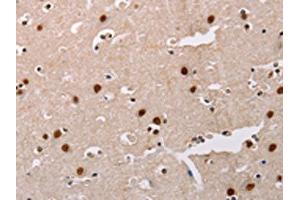 The image on the left is immunohistochemistry of paraffin-embedded Human brain tissue using ABIN7128323(AKAP8L Antibody) at dilution 1/20, on the right is treated with fusion protein. (AKAP8L Antikörper)