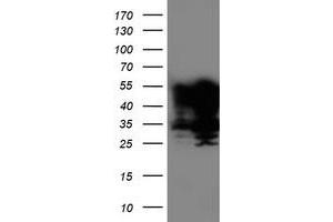 Western Blotting (WB) image for anti-T-Cell Acute Lymphocytic Leukemia 1 (TAL1) antibody (ABIN1501291) (TAL1 Antikörper)