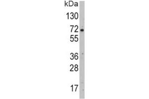 Western blot analysis of GLUT2 antibody and HepG2 lysate. (SLC2A2 Antikörper  (AA 31-60))