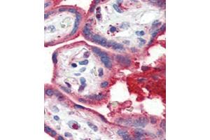 Formalin-fixed and paraffin-embedded human Placenta tissue reacted with OA1 antibody (N-term) 7414a , which was peroxidase-conjugated to the secondary antibody, followed by AEC staining. (APOA1 Antikörper  (N-Term))