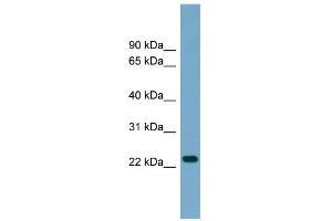 WB Suggested Anti-ARL8B Antibody Titration: 0. (ARL8B Antikörper  (Middle Region))