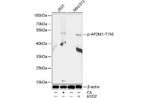 Western blot analysis of extracts of 293T and NIH/3T3 cells, using Phospho-M1-T156 antibody (ABIN7265449) at 1:1000 dilution.